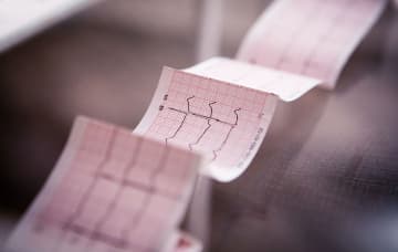 Badanie EKG Badanie EKG